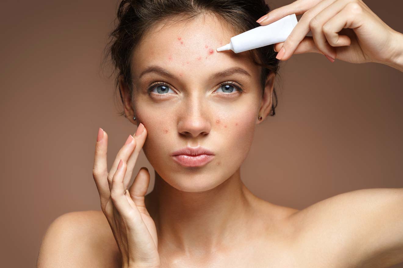 acne treatments Poole and Bournemouth