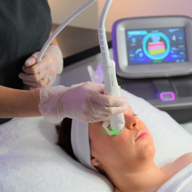 boon-325-650x650 Focus Dual HIFU & RF Microneedling Bournemouth & Poole