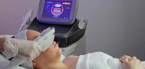 HIFU & RF Microneedling Bournemouth Poole RF Microneedling Bournemouth & Poole