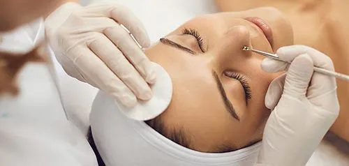 Medical Skin Peels chemical skin peels Bournemouth & Poole